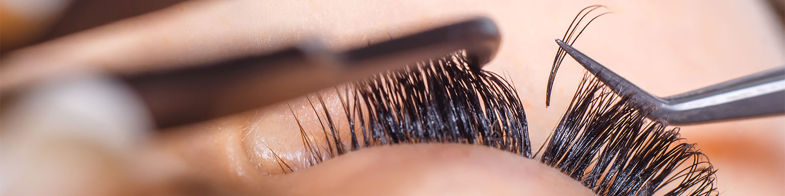 Blakstienų priauginimas Vilniuje