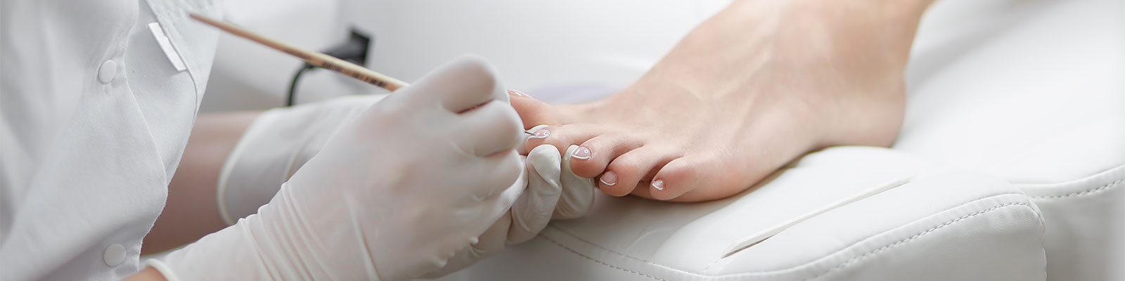 Deformuotų nagų gydymas Vilniuje